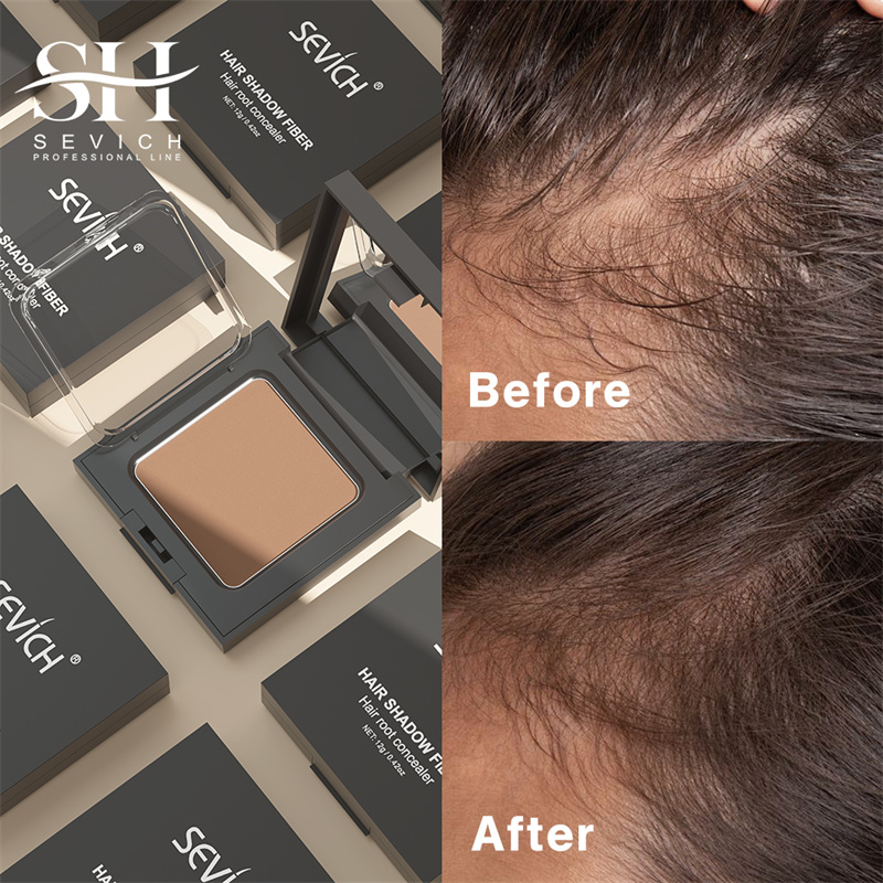 SEVICH 12g Hairline Powder Wit - Rooting Hormone Powder review and price