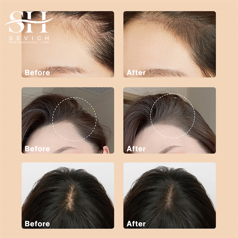 SEVICH 12g Hairline Powder Wit - Rooting Hormone Powder review and price