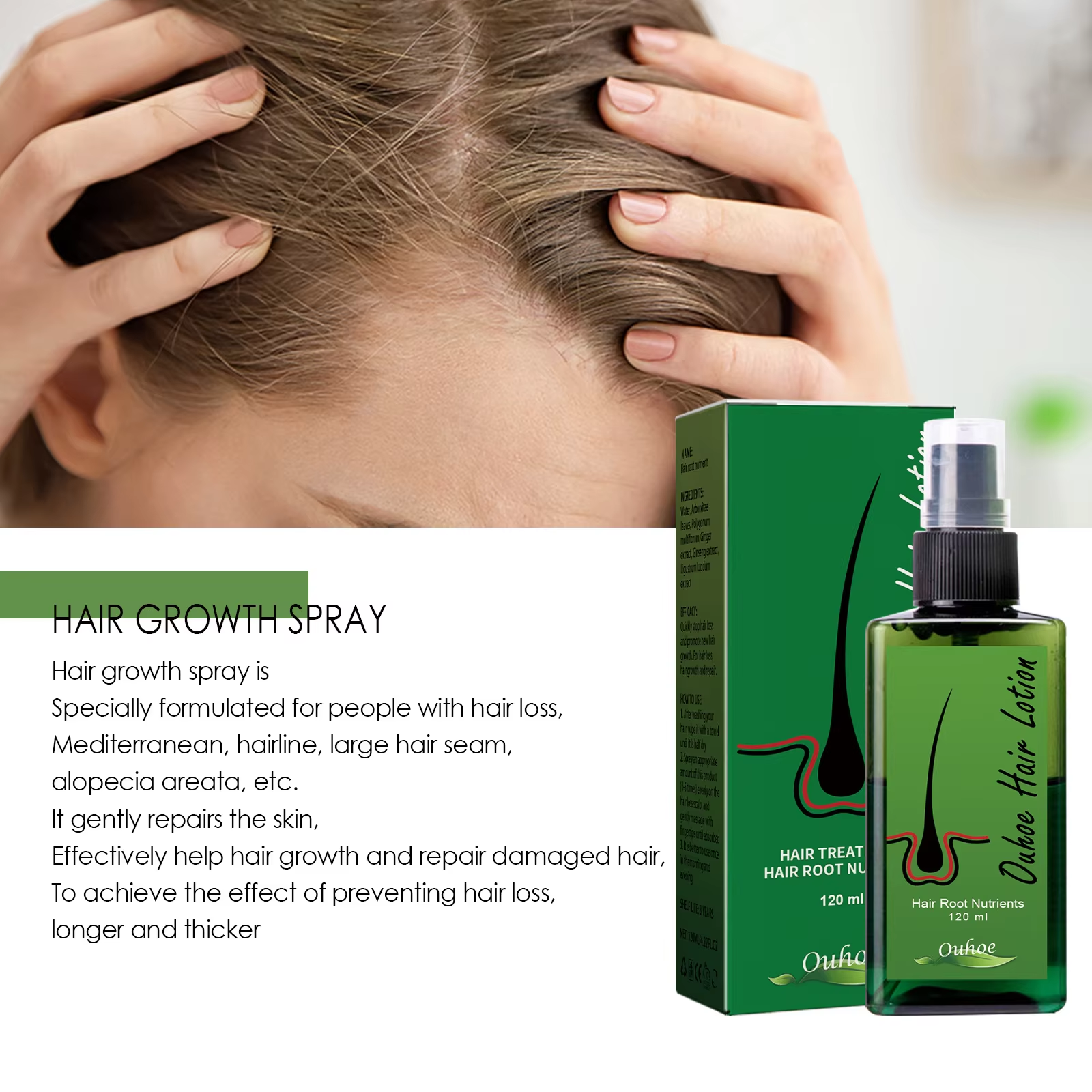 Hair Growth Spray Anti Hair Lo - Root Stimulator Liquid review and price