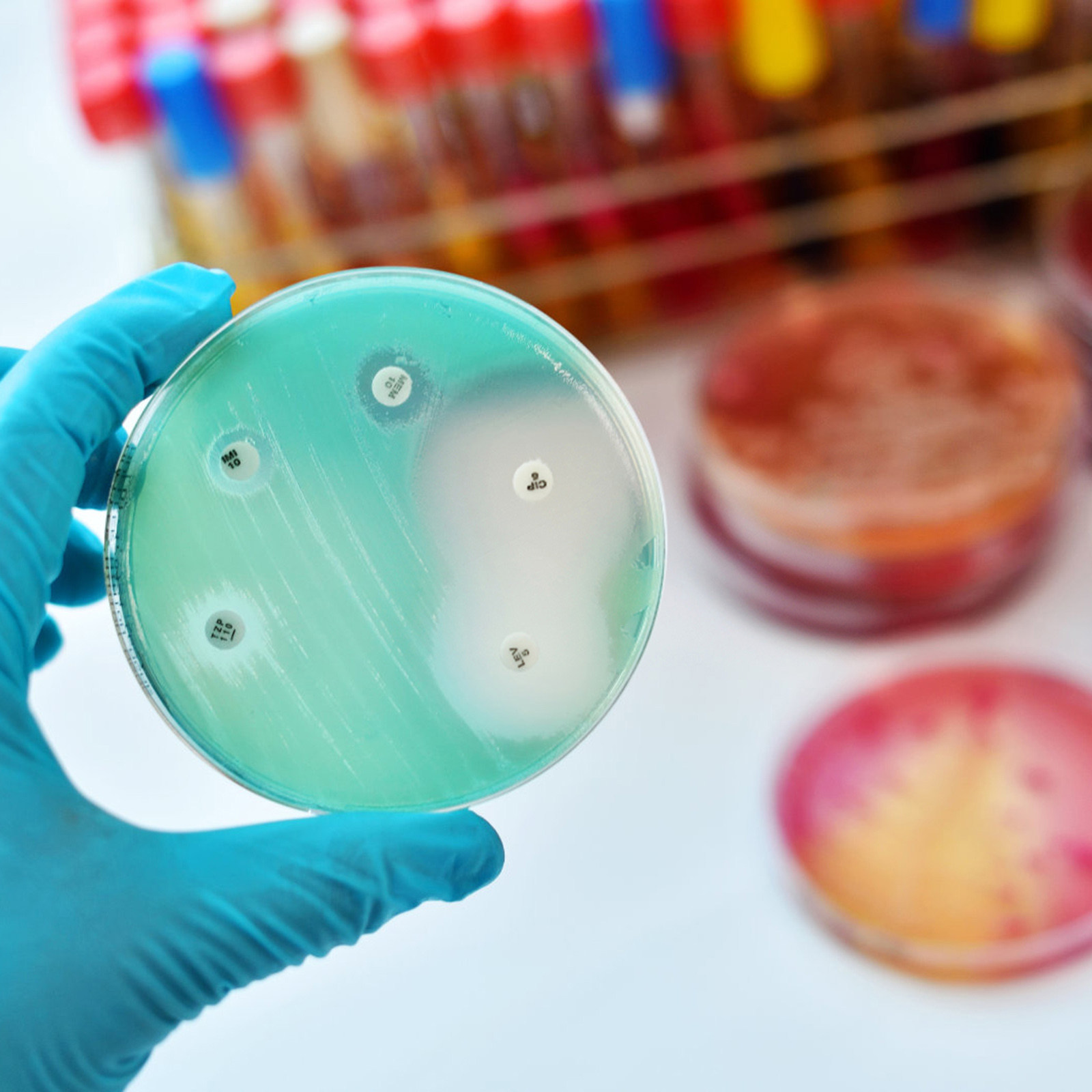 30Pcs Petri Dishes Plastic Cle - Agar Tissue Culture review and price